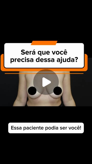 Capa do Reel: fotografia clínica das mamas, com o título “Será que você precisa dessa ajuda?”